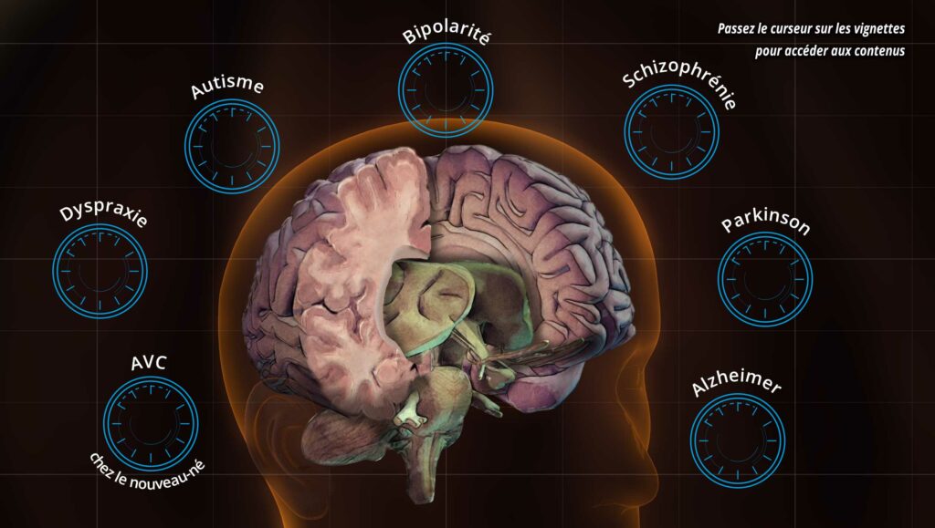 Comment débrancher le cerveau ?