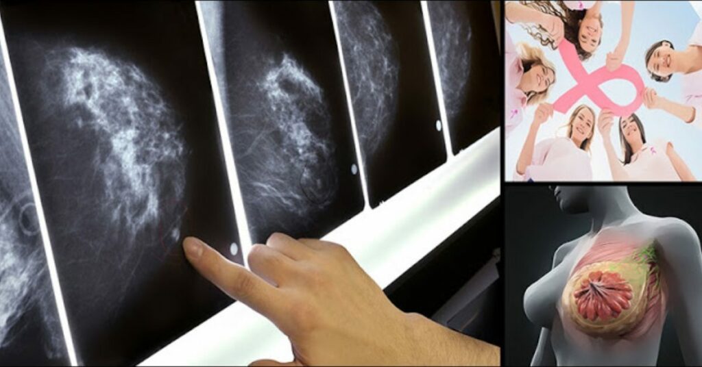 Qu’est-ce qui nourrit le cancer ? Qu'est-ce qui nourrit le cancer ?